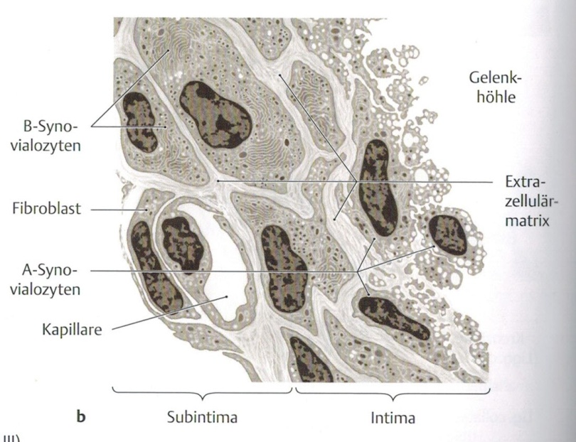 Membrana Synovialis mit Synovialzellen, Fibroblasten, Kapillargefäßen und Synovia